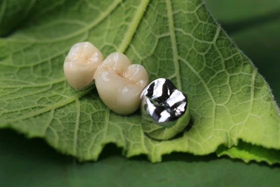 Korona dentystyczna podbudowy metalowej PFM
