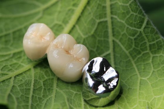 Korona dentystyczna podbudowy metalowej PFM