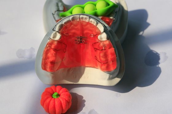 Niestandardowy aparat ortodontyczny Stomatologia ortodontyczna