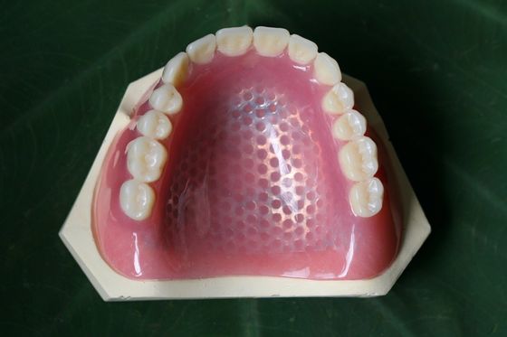 Druk 3D Metalowy szkielet częściowej protezy szkieletowej