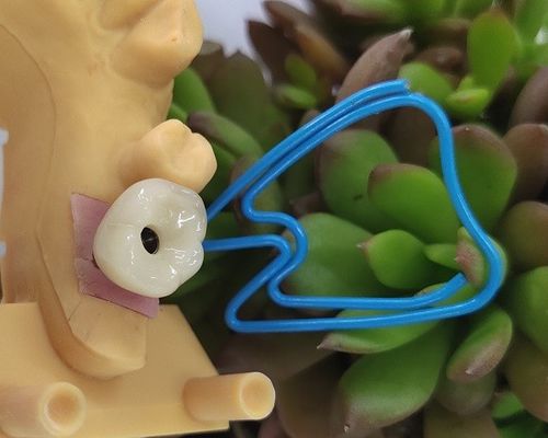 Pojedynczy Ząb Trushine OSSETEM Poziom mocowania implantów dentystycznych