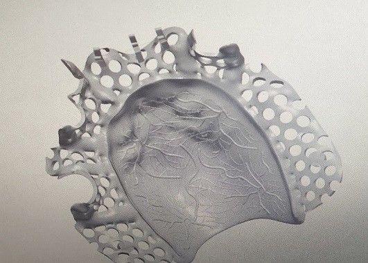 Projekt CAD Konstrukcja metalowa protezy częściowej ze stopu tytanu