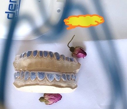 Niestandardowa taca wybielająca ISO13485 do wybielania zębów