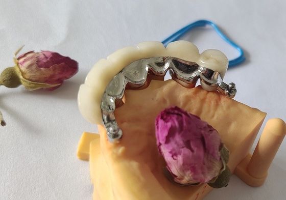 Korona dentystyczna podbudowy metalowej PFM