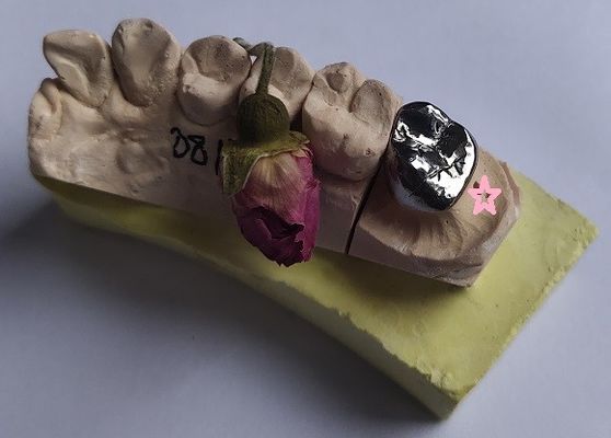 Korona dentystyczna w całości odlewana ze stopów metali nieszlachetnych