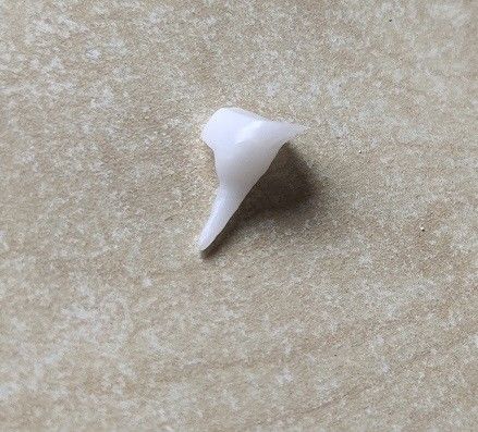 Wzmocnienie porcelanowego rdzenia dentystycznego EMAX
