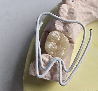 Zęby porcelanowe z cyrkonu
