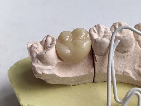 Zęby porcelanowe z cyrkonu