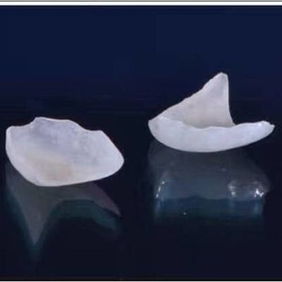 Naturalnie wyglądające wszystkie licówki porcelanowe EMAX Dental Crown