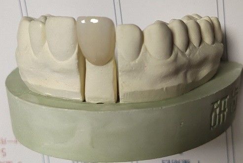 Bloki cyrkonu Dental 3D Print przez frezowanie CAD CAM