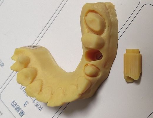 Model 3D o wysokiej precyzji ISO13485 Trushine Dental