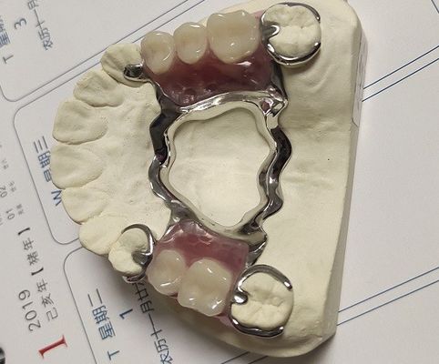 Metalowa konstrukcja protez częściowych ze stopu Co Cr
