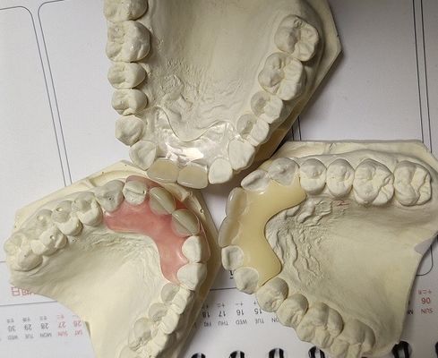 Tymczasowa miękka i elastyczna niewidoczna proteza Valplast