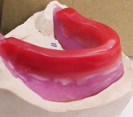 Bloki Trushine Dental Record dla ostatecznych pełnych protez