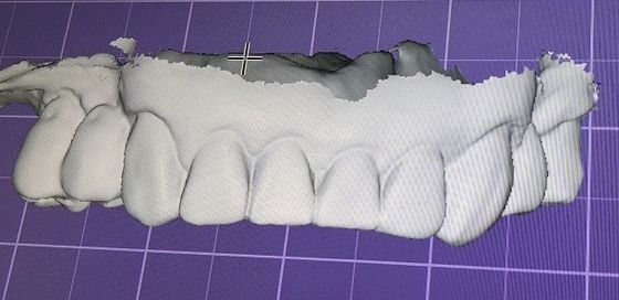 3D Digital Mock Up Teeth Inne produkty dentystyczne