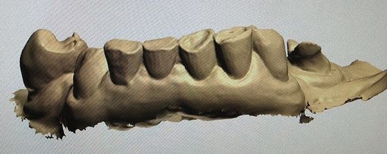 3D Digital Mock Up Teeth Inne produkty dentystyczne