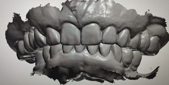 CAD CAM Design Cyfrowy wyświetlacz Mockup Zęby Inne produkty dentystyczne