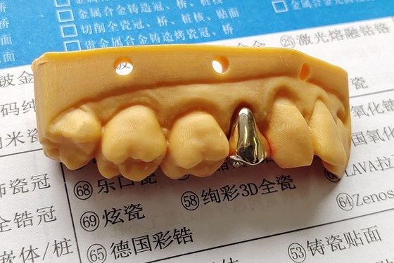 Korona dentystyczna o wysokiej szlachetności złota