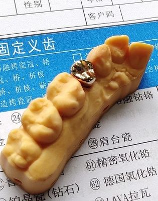 Korona dentystyczna ze stopu wysokiej jakości złota Good Fitness