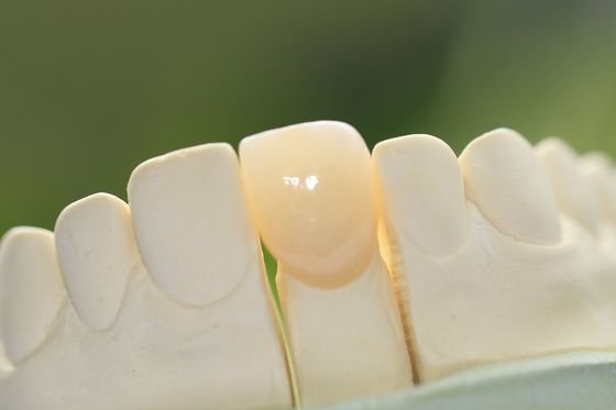 Naturalna trwała szklana ceramiczna korona dentystyczna do zębów przednich