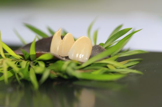 Stomatologia protetyczna Pełna korona z tlenku cyrkonu 5 gwiazdek Design Dental Lab