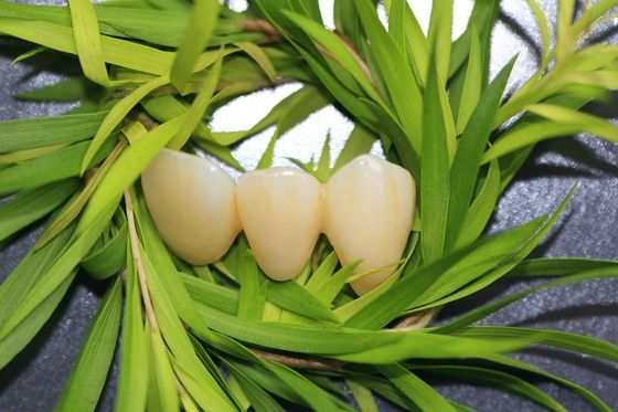 Naturalna korona dentystyczna EMAX