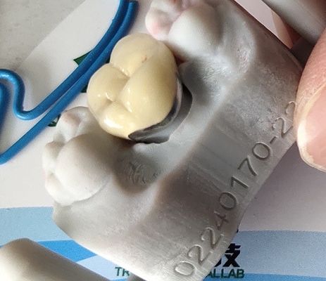 Dental Lab Produkt CAD CAM PFM Korona porcelana zespolona z metalem