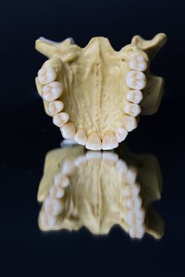 Dental Lab Porcelain Cyrconia Dental Crown 5 gwiazdek Estetyka
