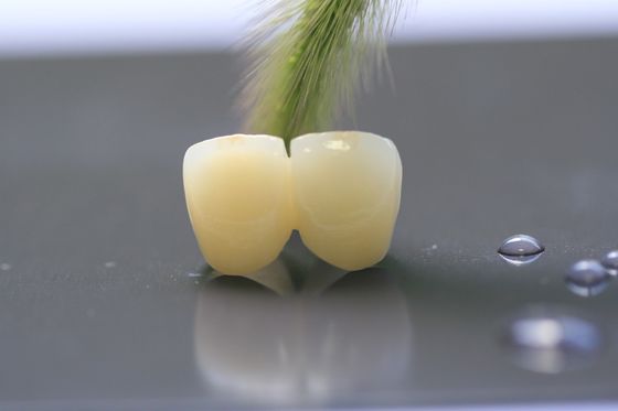 Rama druku 3D PFM Dental Lab Korona do stomatologii