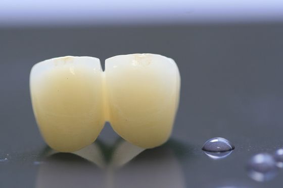 Rama druku 3D PFM Dental Lab Korona do stomatologii