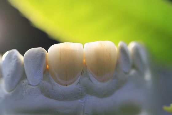 Rama druku 3D PFM Dental Lab Korona do stomatologii