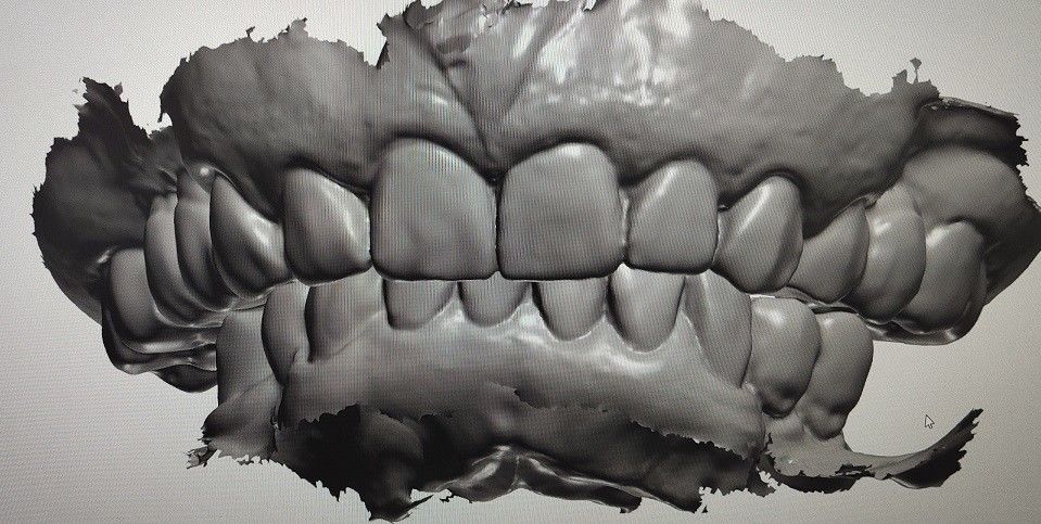 CAD CAM Design Cyfrowy wyświetlacz Mockup Zęby Inne produkty dentystyczne