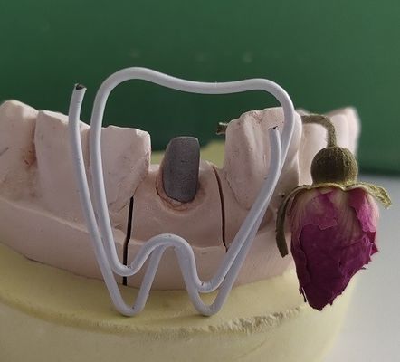 Metalowy słupek dentystyczny i rdzeń po leczeniu endodontycznym