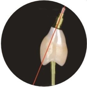 Naturalna korona implantów dentystycznych ze śrubą kątową ASC
