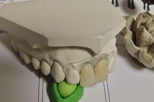 Tymczasowa miękka i elastyczna niewidoczna proteza Valplast